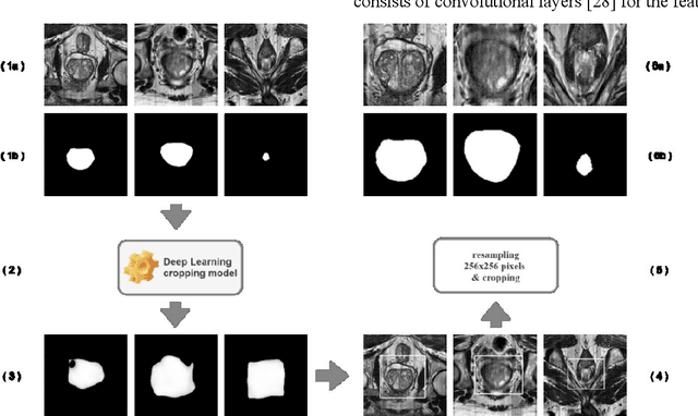 Figure 3 for A new smart-cropping pipeline for prostate segmentation using deep learning networks