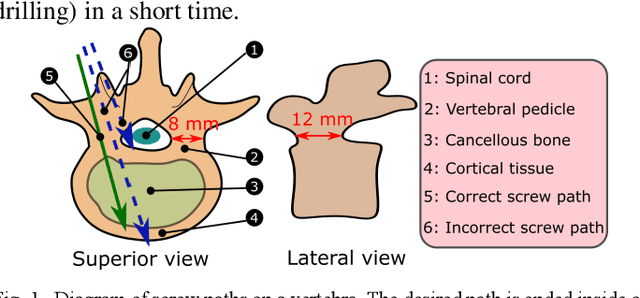 Figure 1 for Model-Based Compensation of Moving Tissue for State Recognition in Robotic-Assisted Pedicle Drilling