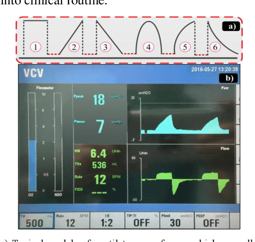 Figure 2 for Model-Based Compensation of Moving Tissue for State Recognition in Robotic-Assisted Pedicle Drilling