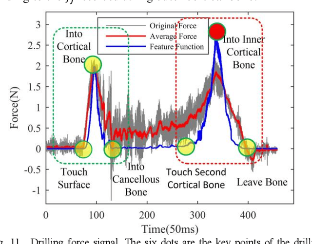 Figure 3 for Model-Based Compensation of Moving Tissue for State Recognition in Robotic-Assisted Pedicle Drilling