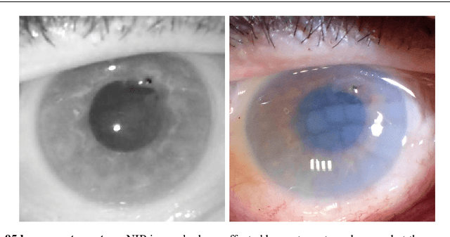 Figure 3 for Post-mortem Iris Decomposition and its Dynamics in Morgue Conditions