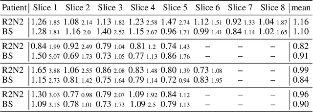 Figure 2 for Recurrent Registration Neural Networks for Deformable Image Registration