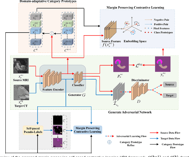 Figure 4 for Margin Preserving Self-paced Contrastive Learning Towards Domain Adaptation for Medical Image Segmentation