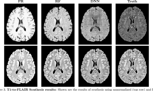 Figure 3 for Evaluating the Impact of Intensity Normalization on MR Image Synthesis