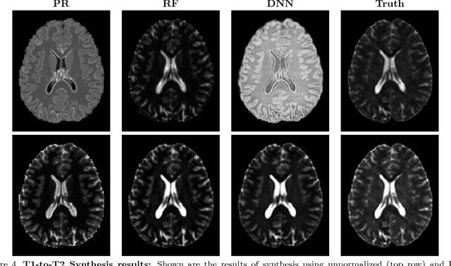 Figure 4 for Evaluating the Impact of Intensity Normalization on MR Image Synthesis