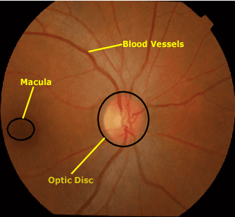 Figure 1 for Retinal Optic Disc Segmentation using Conditional Generative Adversarial Network