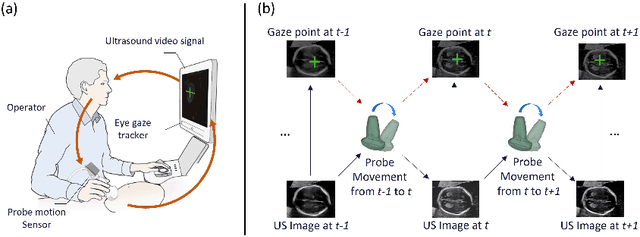 Figure 1 for Multimodal-GuideNet: Gaze-Probe Bidirectional Guidance in Obstetric Ultrasound Scanning