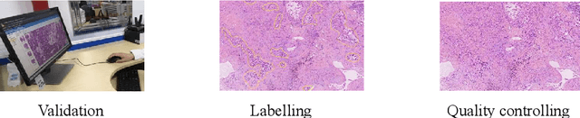 Figure 3 for Preparing data for pathological artificial intelligence with clinical-grade performance