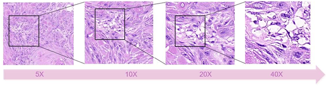 Figure 4 for Preparing data for pathological artificial intelligence with clinical-grade performance