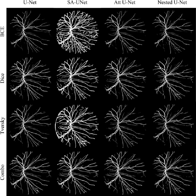 Figure 4 for Impact of loss function in Deep Learning methods for accurate retinal vessel segmentation