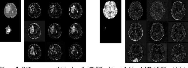Figure 3 for Deep Generative Models in the Real-World: An Open Challenge from Medical Imaging
