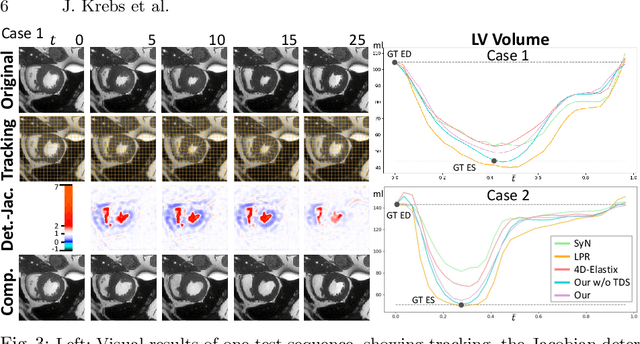 Figure 3 for Probabilistic Motion Modeling from Medical Image Sequences: Application to Cardiac Cine-MRI