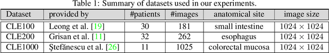 Figure 2 for WhiteNNer-Blind Image Denoising via Noise Whiteness Priors