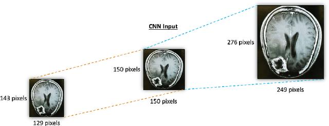 Figure 3 for Computational Intelligence Approach to Improve the Classification Accuracy of Brain Neoplasm in MRI Data