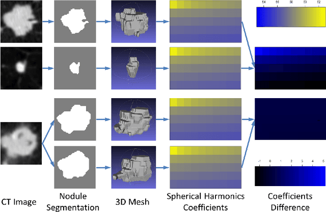 Figure 1 for Characterization of Lung Nodule Malignancy using Hybrid Shape and Appearance Features