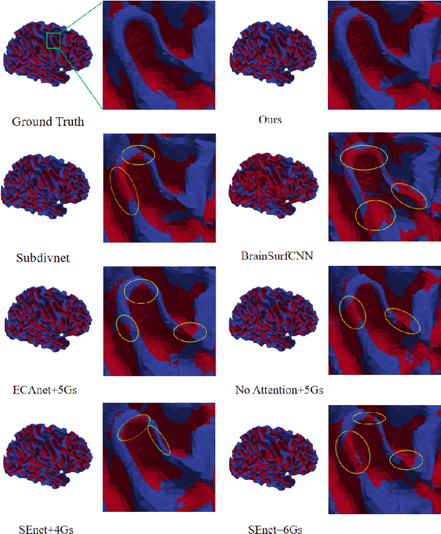 Figure 3 for Brain Cortical Functional Gradients Predict Cortical Folding Patterns via Attention Mesh Convolution