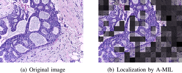 Figure 4 for Breast Cancer Histopathology Image Classification and Localization using Multiple Instance Learning