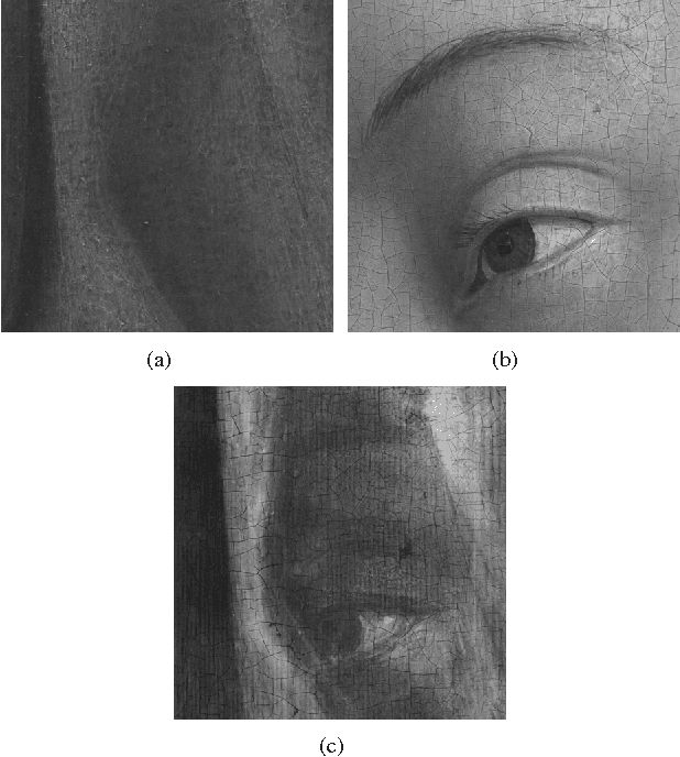 Figure 1 for X-ray image separation via coupled dictionary learning
