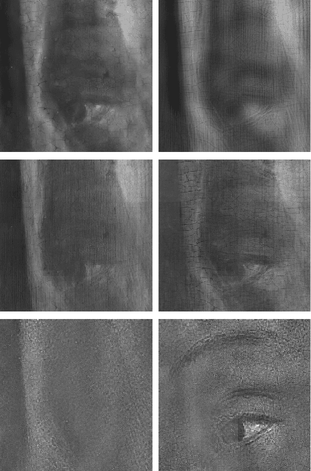 Figure 3 for X-ray image separation via coupled dictionary learning