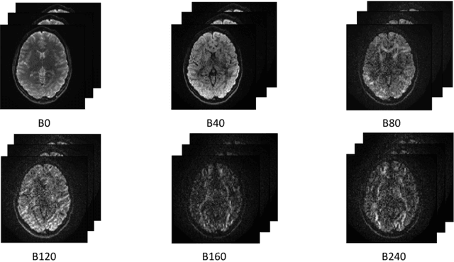 Figure 1 for End to End Brain Fiber Orientation Estimation using Deep Learning
