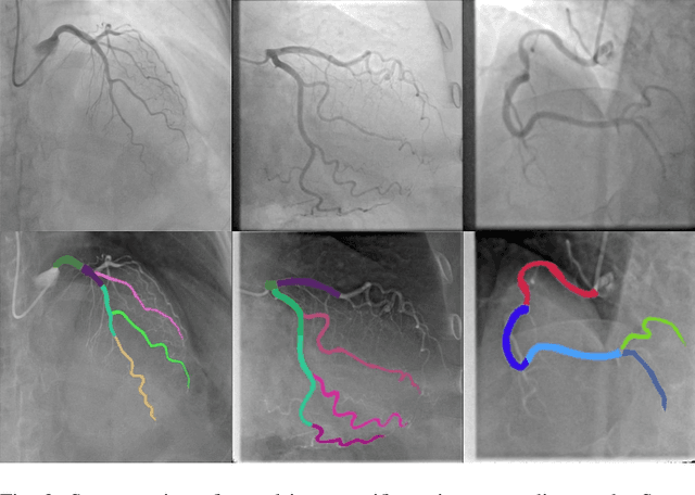 Figure 2 for A Review of Modern Approaches for Coronary Angiography Imaging Analysis