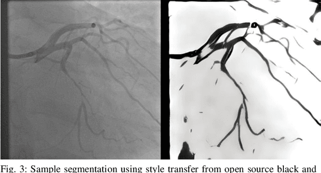 Figure 3 for A Review of Modern Approaches for Coronary Angiography Imaging Analysis