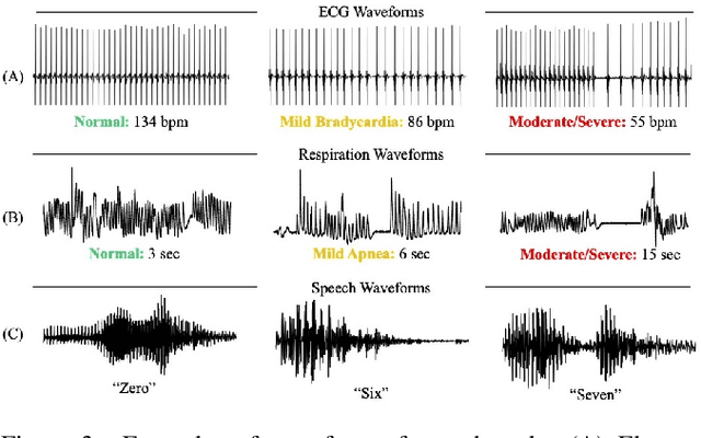 Figure 4 for Explaining Deep Classification of Time-Series Data with Learned Prototypes