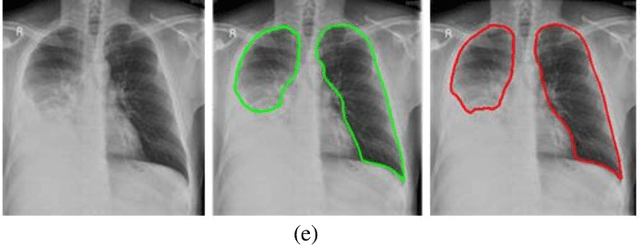 Figure 4 for Deep LF-Net: Semantic Lung Segmentation from Indian Chest Radiographs Including Severely Unhealthy Images