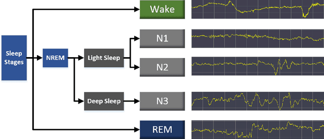 Figure 1 for Sleep Staging Based on Serialized Dual Attention Network