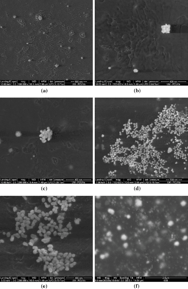 Figure 3 for Estimating the concentration of gold nanoparticles incorporated on Natural Rubber membranes using Multi-Level Starlet Optimal Segmentation