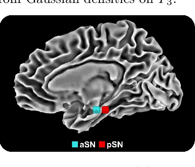 Figure 1 for A CNN for homogneous Riemannian manifolds with applications to Neuroimaging
