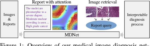 Figure 1 for MDNet: A Semantically and Visually Interpretable Medical Image Diagnosis Network