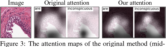 Figure 4 for MDNet: A Semantically and Visually Interpretable Medical Image Diagnosis Network