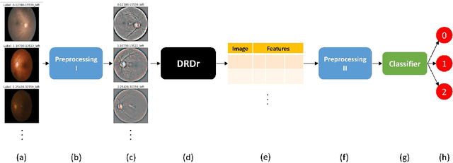 Figure 1 for DRDr II: Detecting the Severity Level of Diabetic Retinopathy Using Mask RCNN and Transfer Learning