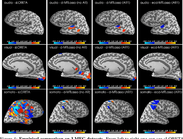 Figure 4 for Statistical control for spatio-temporal MEG/EEG source imaging with desparsified multi-task Lasso