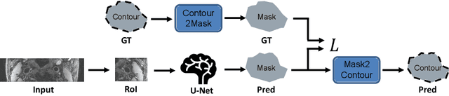 Figure 1 for Segmentation of the Carotid Lumen and Vessel Wall using Deep Learning and Location Priors