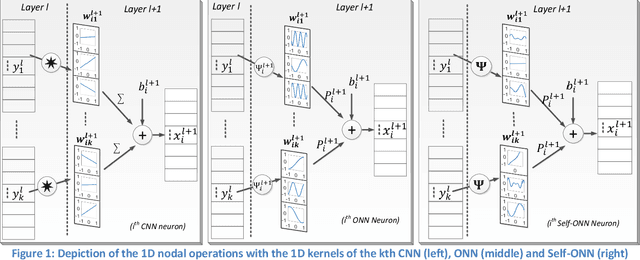 Figure 1 for Early Bearing Fault Diagnosis of Rotating Machinery by 1D Self-Organized Operational Neural Networks