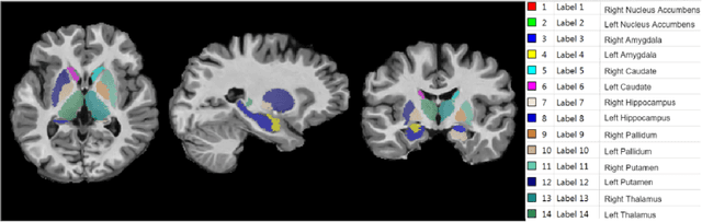 Figure 3 for Sub-cortical structure segmentation database for young population
