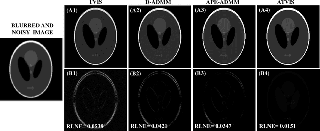 Figure 1 for Compressed Sensing Parallel MRI with Adaptive Shrinkage TV Regularization