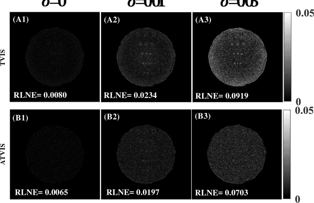 Figure 4 for Compressed Sensing Parallel MRI with Adaptive Shrinkage TV Regularization