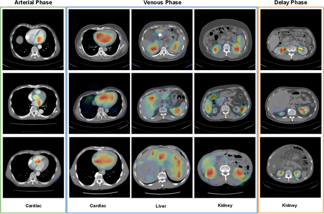 Figure 3 for CT Data Curation for Liver Patients: Phase Recognition in Dynamic Contrast-Enhanced CT
