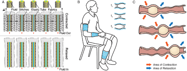 Figure 1 for A peristaltic soft, wearable robot for compression and massage therapy