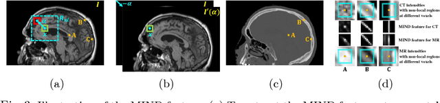 Figure 3 for Unpaired Brain MR-to-CT Synthesis using a Structure-Constrained CycleGAN