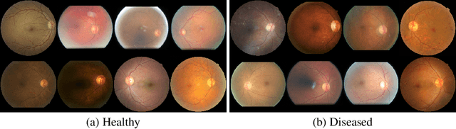 Figure 2 for Defending Medical Image Diagnostics against Privacy Attacks using Generative Methods