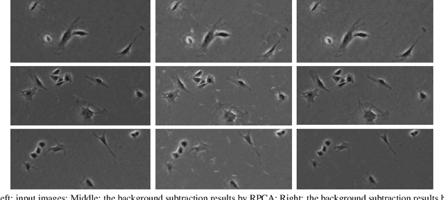 Figure 4 for An Efficient Approach for Cell Segmentation in Phase Contrast Microscopy Images