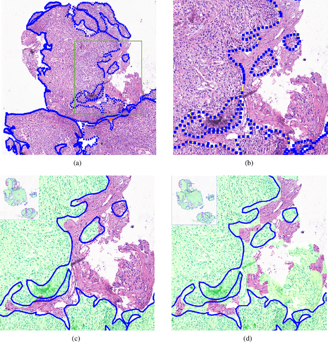 Figure 3 for Deep Learning Methods for Lung Cancer Segmentation in Whole-slide Histopathology Images -- the ACDC@LungHP Challenge 2019