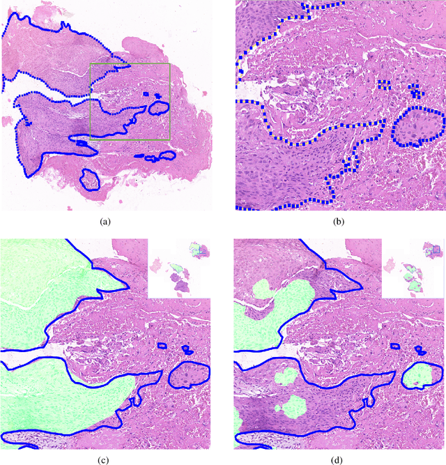Figure 4 for Deep Learning Methods for Lung Cancer Segmentation in Whole-slide Histopathology Images -- the ACDC@LungHP Challenge 2019