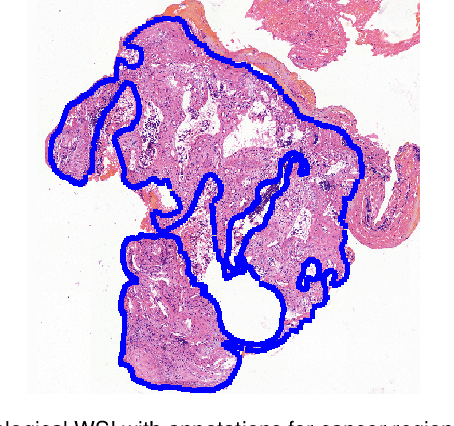 Figure 1 for Deep Learning Methods for Lung Cancer Segmentation in Whole-slide Histopathology Images -- the ACDC@LungHP Challenge 2019