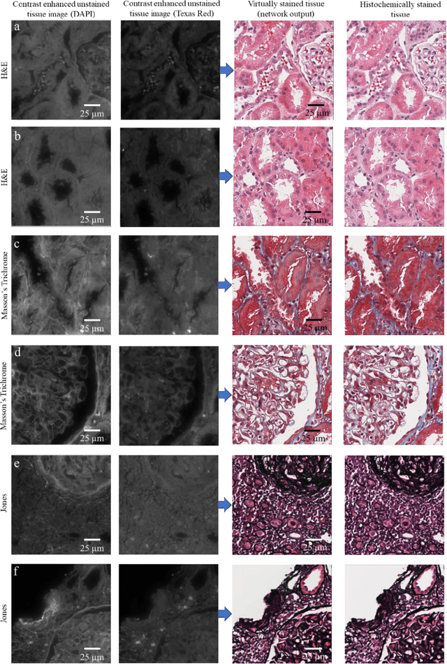 Figure 4 for Digital synthesis of histological stains using micro-structured and multiplexed virtual staining of label-free tissue