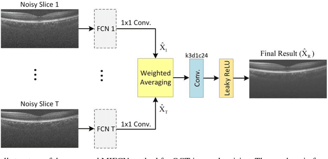 Figure 1 for Three-dimensional Optical Coherence Tomography Image Denoising via Multi-input Fully-Convolutional Networks